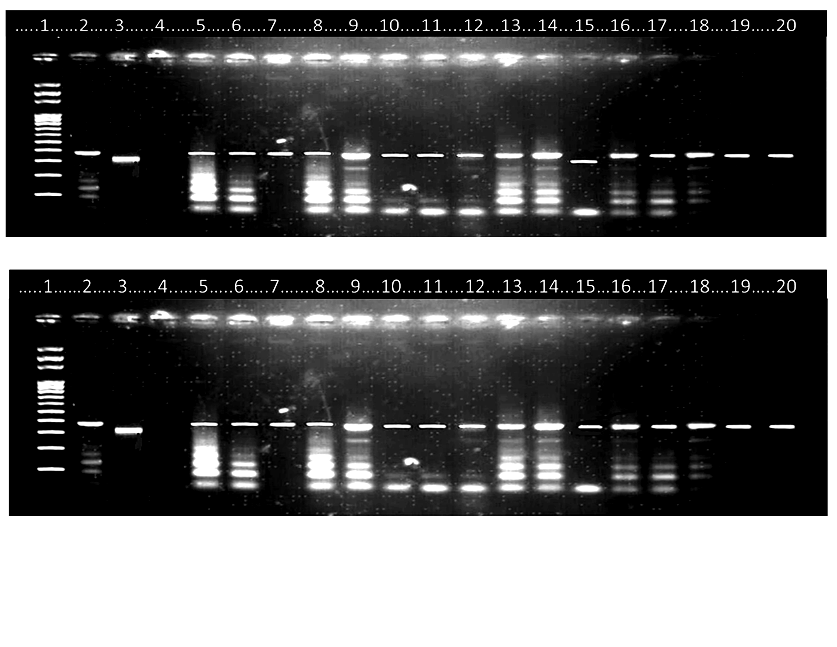 : UV illuminated Agarose gel showing PCR amplified DNA fragments bands for identification of members of An. gambiae complex from study sites.Lane 1: 100-basepair, DNA size marker ladder, Lane 2:  An. gambiae s.s.  positive control (390 bp), Lanes 3: An. Arabiensis positive control (315 bp), Lane 4: Negative control, Lane 5-20:  An. gambiae s.s (wild samples)