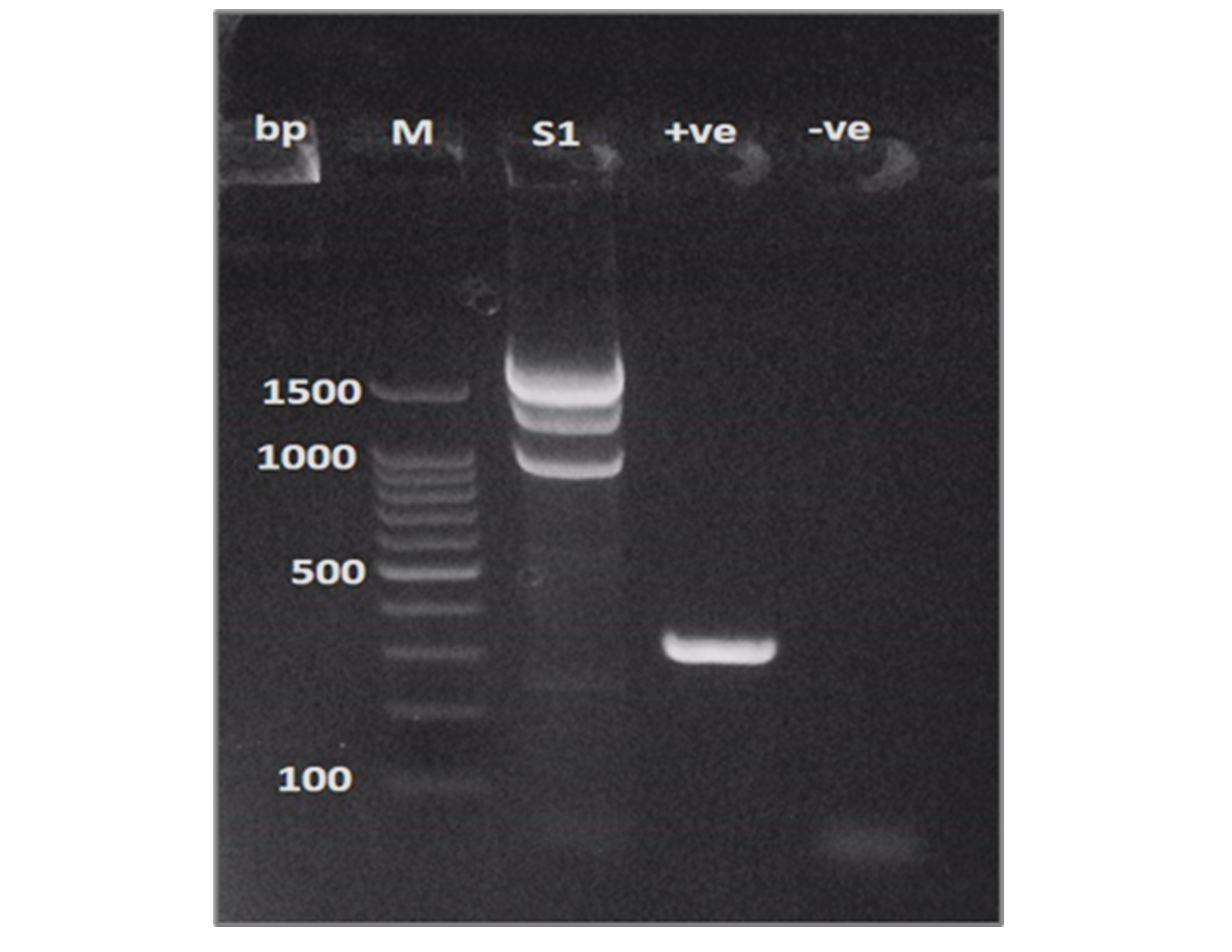Polymerase chain reaction result: the first well shows DNA marker, and the next well indicates negative mecA gene which was supposed to be identified at 336bps as shown by the positive control in the third well. The thick multiple bands found in the same well with the DNA are non-relevant genes.
