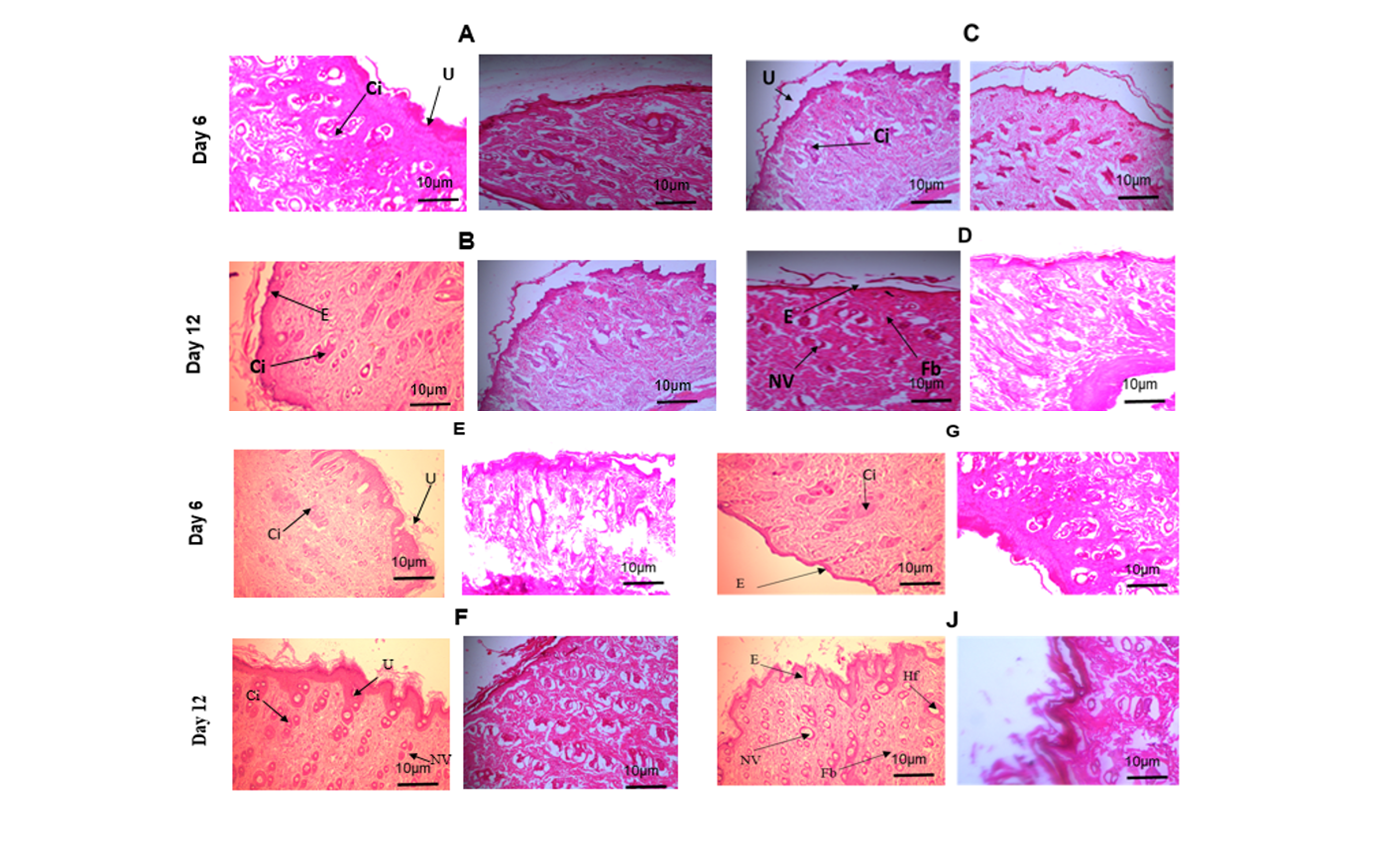 Histological observation of wounds on Day 6 and Day 12.  A = Gel/KOH; B= Gel/KOH l; C= Gel-/R1; D= Gel-/R1 ; E=L Mesitran; F=L Mesitran ; G= Gel+/R1; H= Gel+/KR1    Nv = Neovascularization; Hf = Hair follicle; Fb = Fibroblast; U= Ulceration; E = Squamous epithelium; Ci=inflammators cells. Hematoxylineosin (H&E) staining. Olympus BX 51 light microscope. Scale bar is 10 μm.