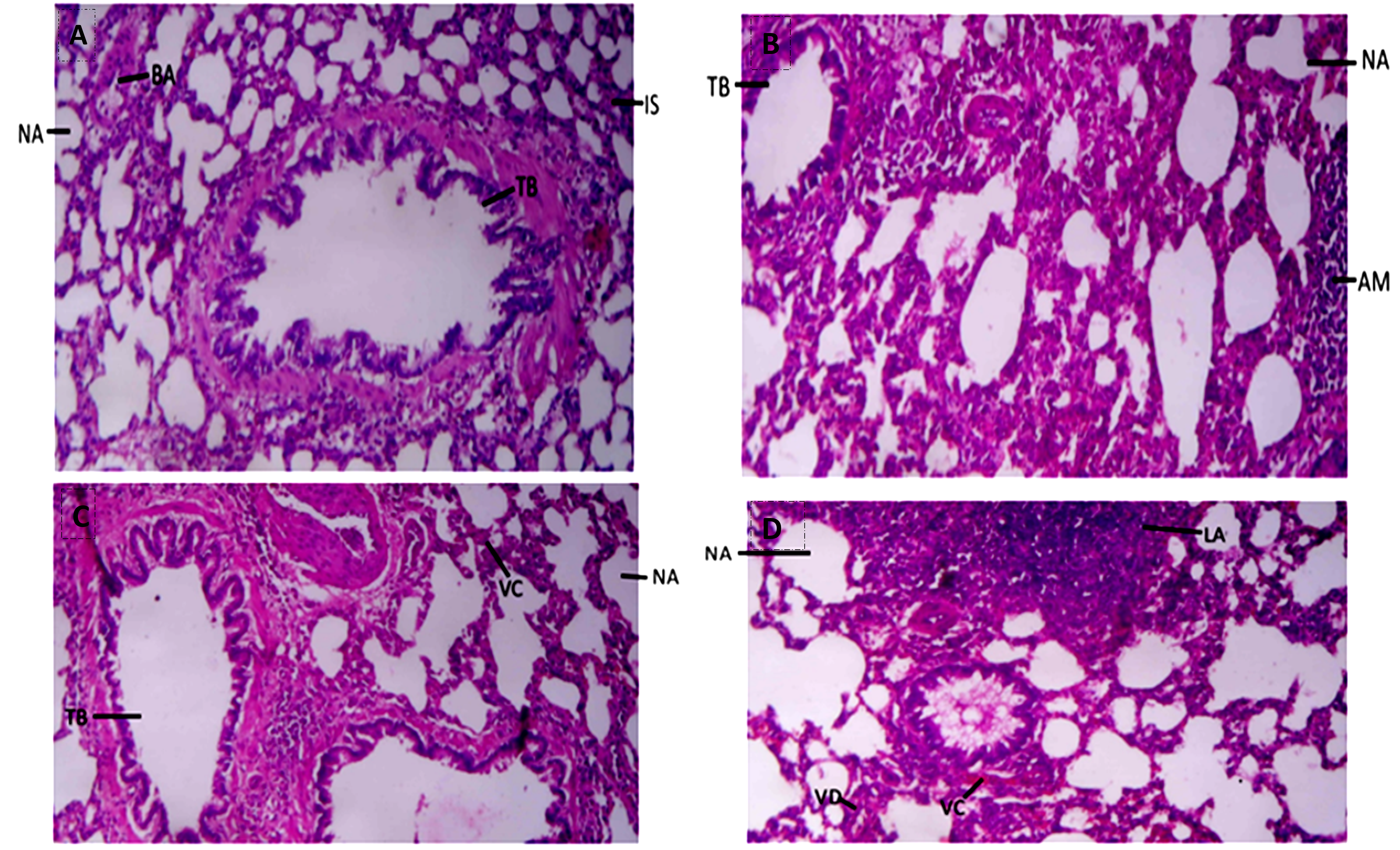 Rat lungs control show; normal alveoli (NV), bronchial artery (BA), interstitial space (IS) and terminal bronchiole (TB); plate B. Rats lungs given 50mg/kg of caffeine show: normal alveoli (NA), dilated terminal bronchiole (TB) and activated mononuclear phagocyte cell (AM), plate C. Rats lungs given 100mg/kg of caffeine show: normal alveoli (NA), interstitial congestion (VC) and dilated terminal bronchioles (TB), plate D. Rats lungs given 200mg/kg of caffeine show: normal alveoli (NA), interstitial vasodilation (VD) and congestion (VC), activated bronchio-alveolar lymphoid aggregate, H&E 100X