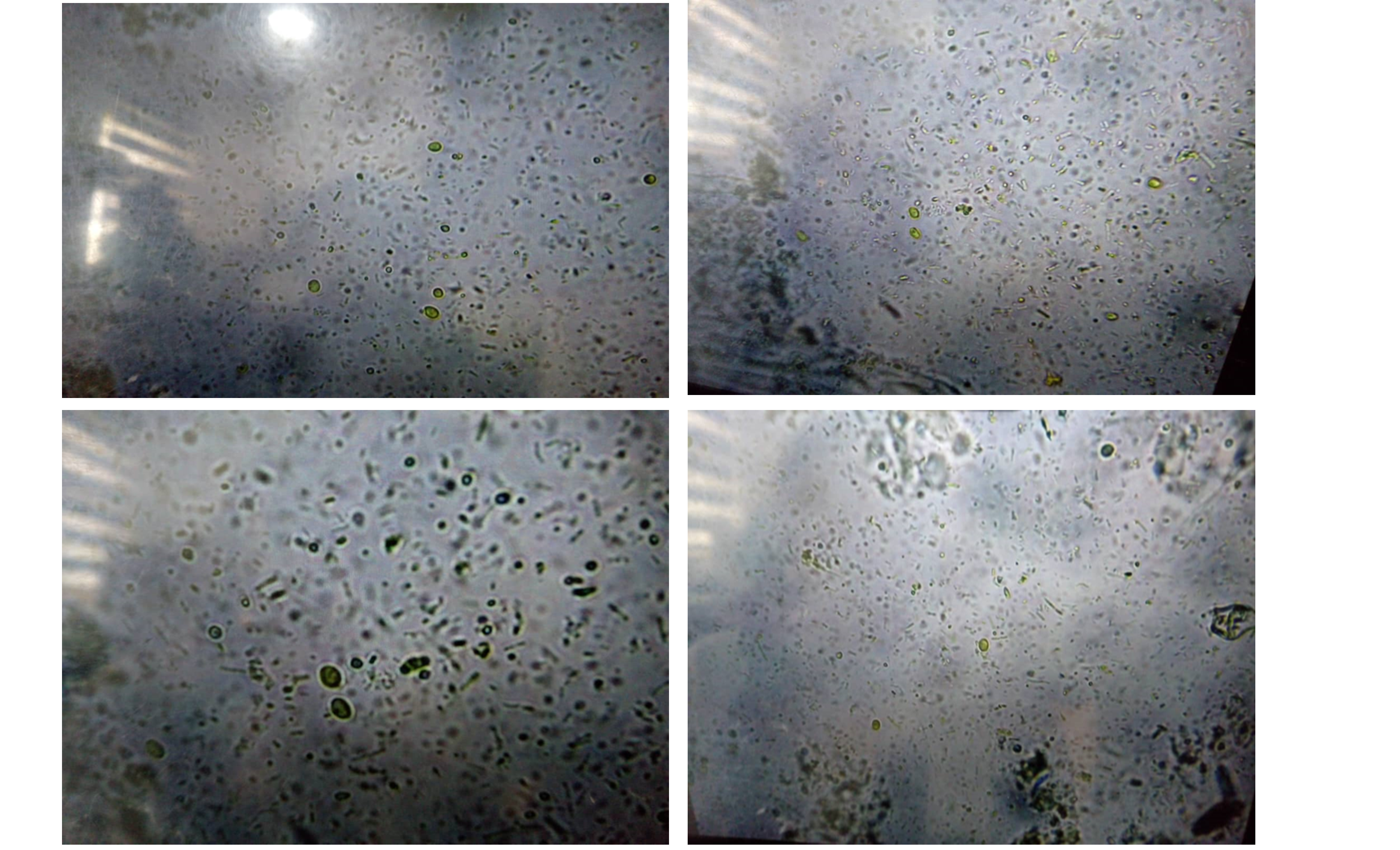 Giardia lamblia Infection among Primary School Pupils in Kaduna Metropolis